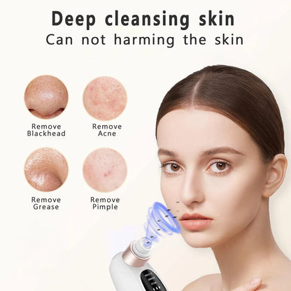 Blackhead Vacuum Remover