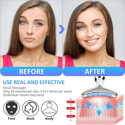 Skin Rejuvenating Device