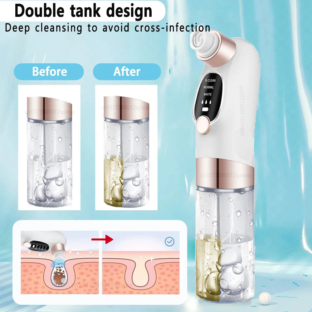 Blackhead Vacuum Remover