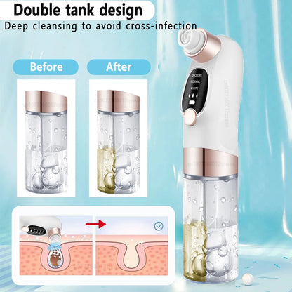Blackhead Vacuum Remover
