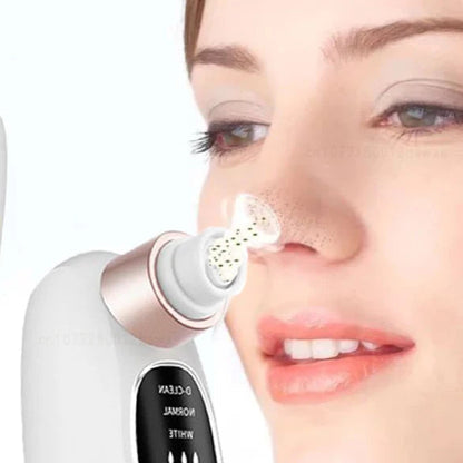 Blackhead Vacuum Remover