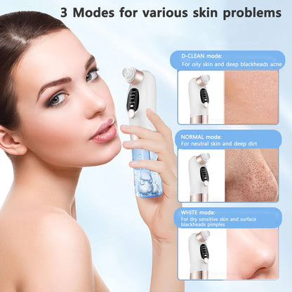 Blackhead Vacuum Remover