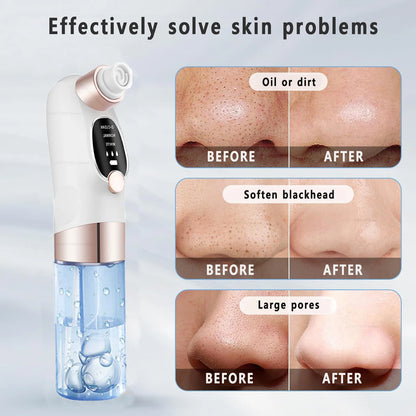 Blackhead Vacuum Remover
